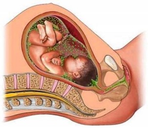 Tekening van een baby in de baarmoeder