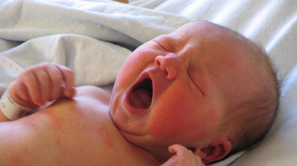 Neonatologie Neonatologie