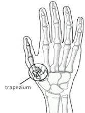 tekening botjes hand