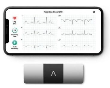 plaatje van telefoon en het opname apparaat (kardia)
